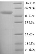 (Tris-Glycine gel) Discontinuous SDS-PAGE (reduced) with 5% enrichment gel and 15% separation gel.